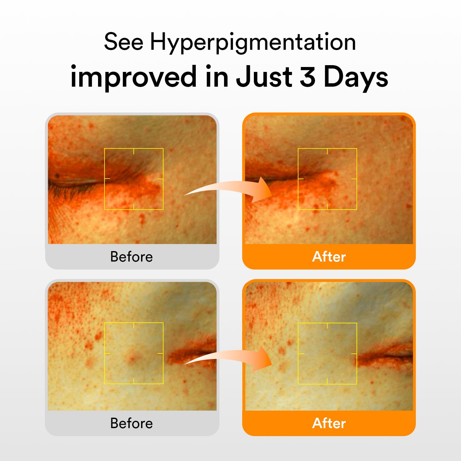 Abib Glutathiosome Dark Spot Serum Vita drop 1.69 fl.oz. | Korean Skincare, Dark Spot, Hyperpigmentation Treatment | Brightening Serum for Sensitive, Uneven Skin | Niacinamide, Viatmin C